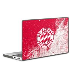 Hard Case for MacBook anthracite