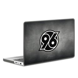 Hard Case für MacBook anthrazit