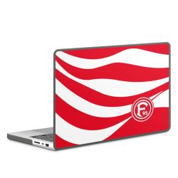 Hard Case für MacBook anthrazit