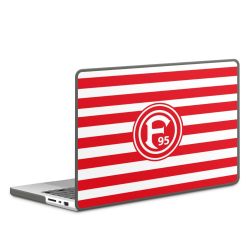 Hard Case für MacBook anthrazit