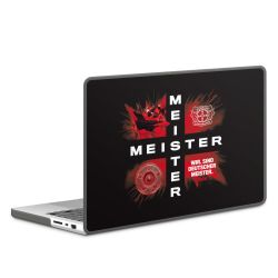 Hard Case für MacBook anthrazit