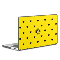 Hard Case for MacBook anthracite