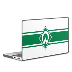 Hard Case für MacBook anthrazit