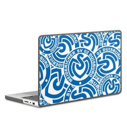 Hard Case für MacBook anthrazit