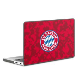 Hard Case for MacBook anthracite