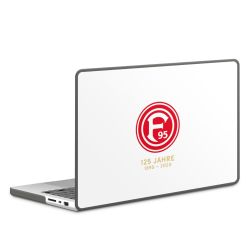 Hard Case für MacBook anthrazit