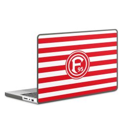 Hard Case für MacBook anthrazit