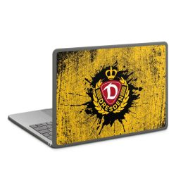 Hard Case für MacBook anthrazit