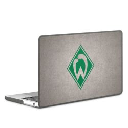 Hard Case für MacBook anthrazit