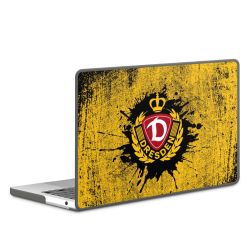 Hard Case für MacBook anthrazit