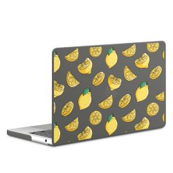 Hard Case for MacBook anthracite