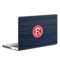 MacBook Case anthrazit