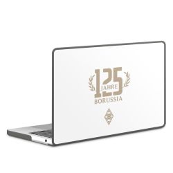 MacBook Case anthrazit