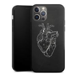 Silikonskal Slim svart