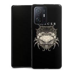 Silikonskal Slim svart