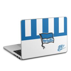 Folien für Laptops matt