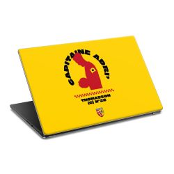 SkinVinyyli Läppäreille mattapinta