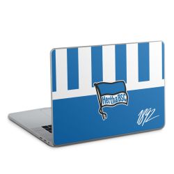 Folien für Laptops matt