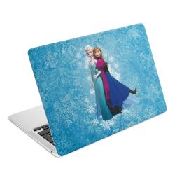 Folier Bärbara datorer matt