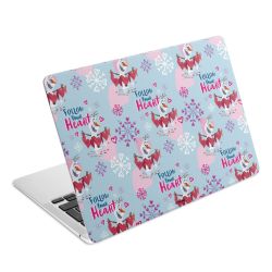 Folier Bärbara datorer matt