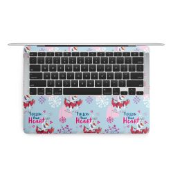 Folier Bärbara datorer matt