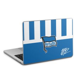 Folien für Laptops matt