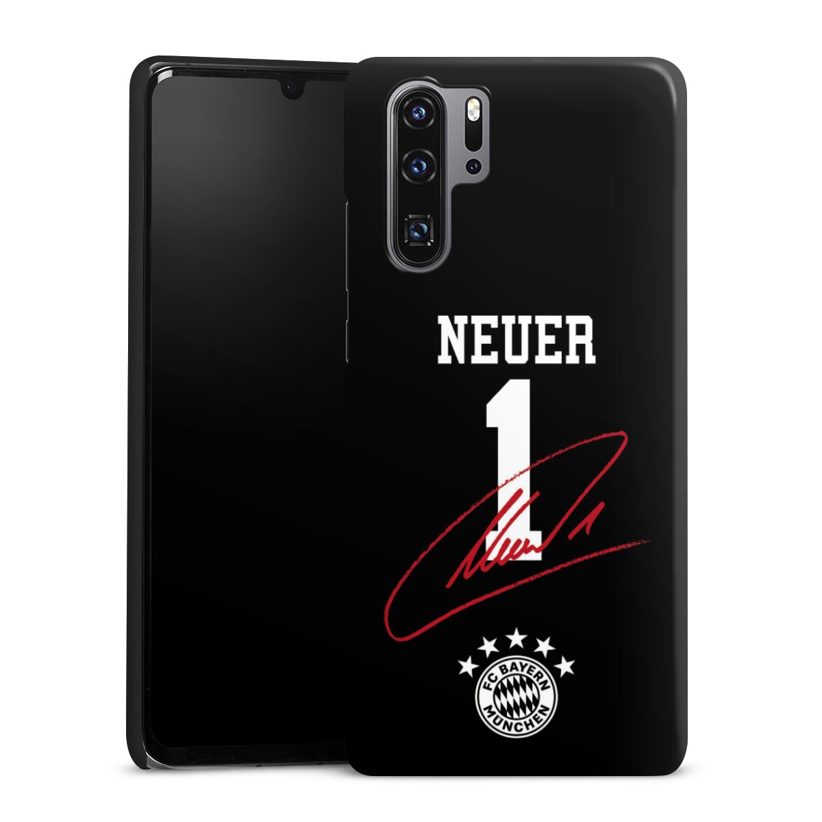 Coque Premium