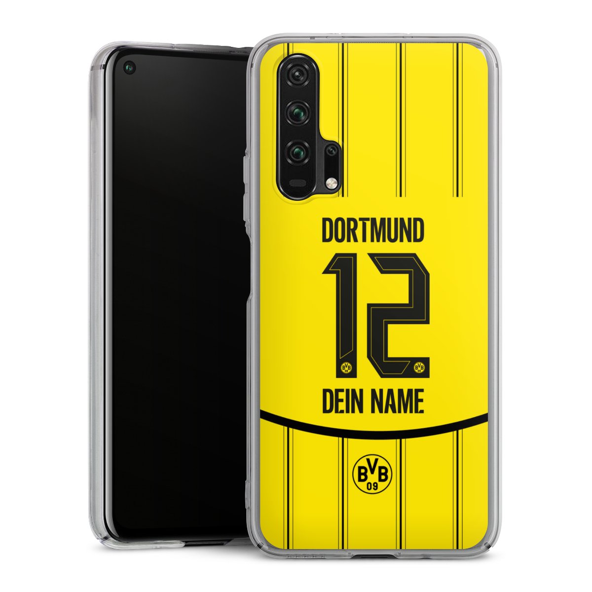 Borussia Dortmund Trikot Personalisierbar