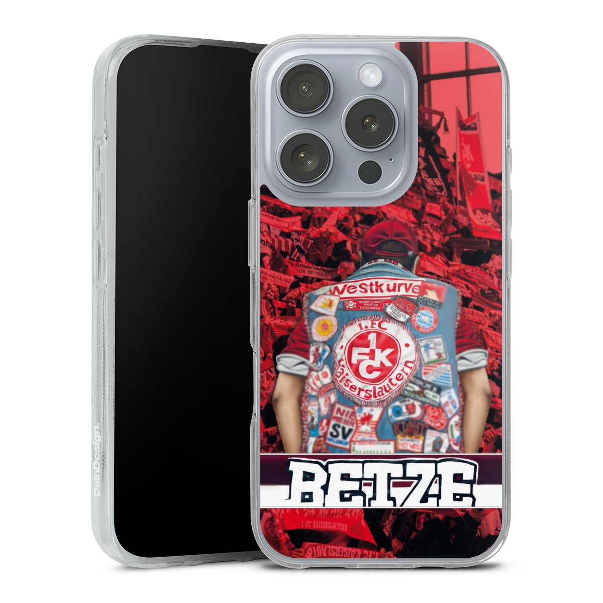 1.FCK Betze