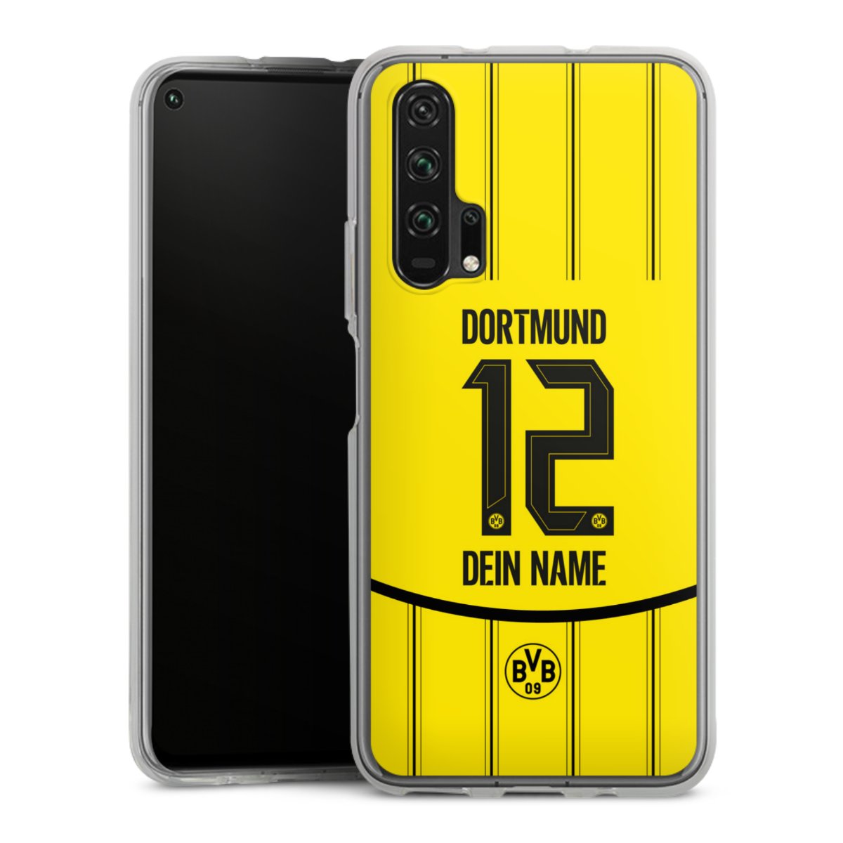 Borussia Dortmund Trikot Personalisierbar