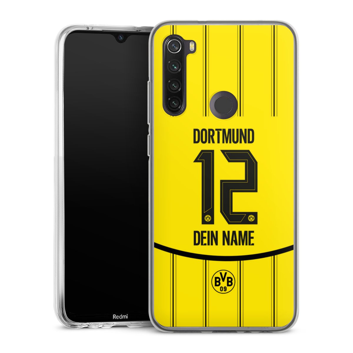 Borussia Dortmund Trikot Personalisierbar