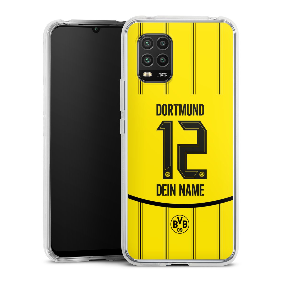 Borussia Dortmund Trikot Personalisierbar