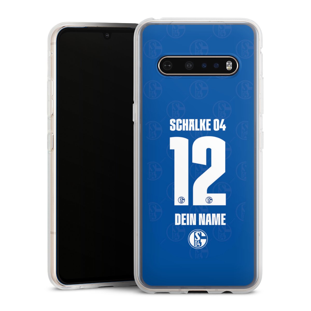 Schalke 04 Trikot Personalisierbar