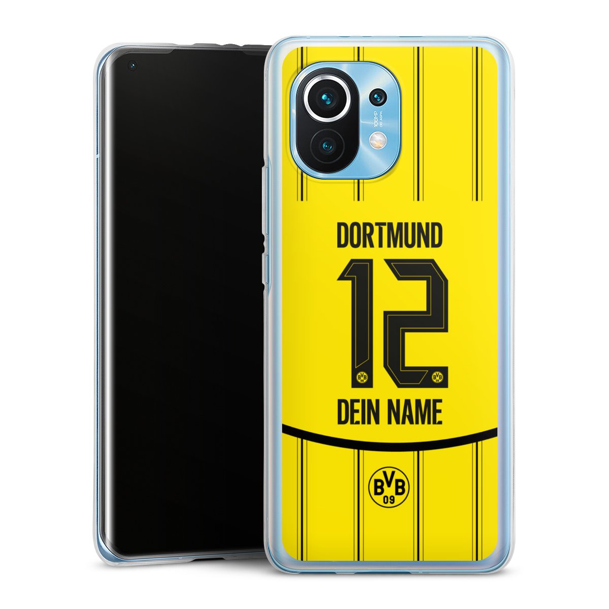 Borussia Dortmund Trikot Personalisierbar