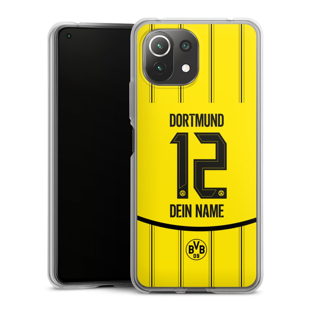 Borussia Dortmund Trikot Personalisierbar