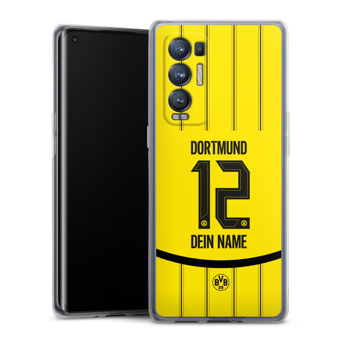 Borussia Dortmund Trikot Personalisierbar