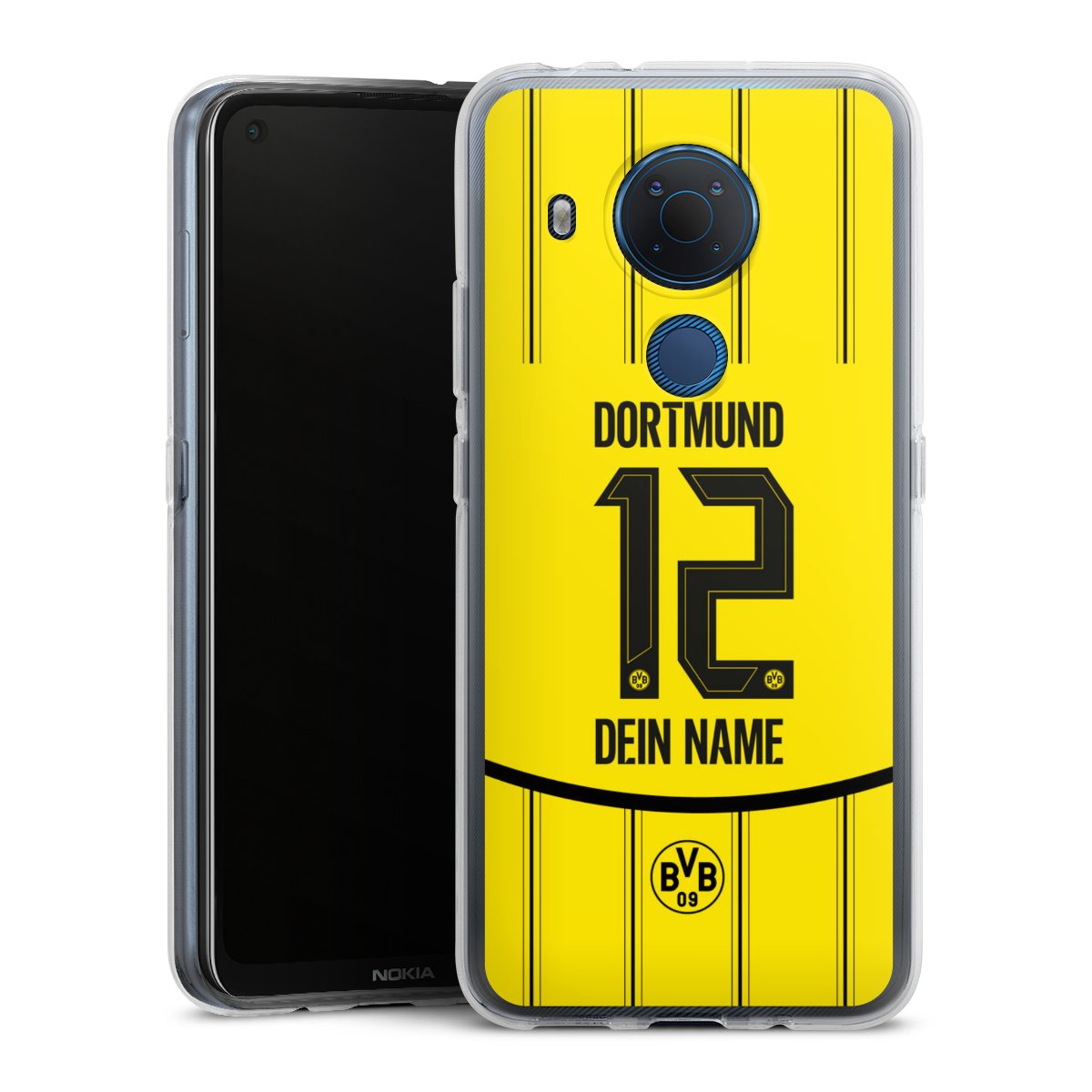 Borussia Dortmund Trikot Personalisierbar