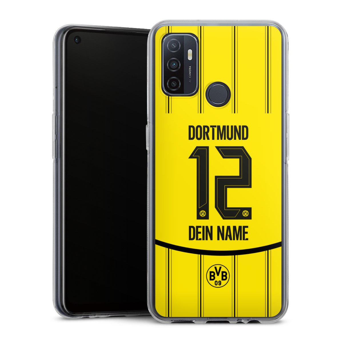 Borussia Dortmund Trikot Personalisierbar