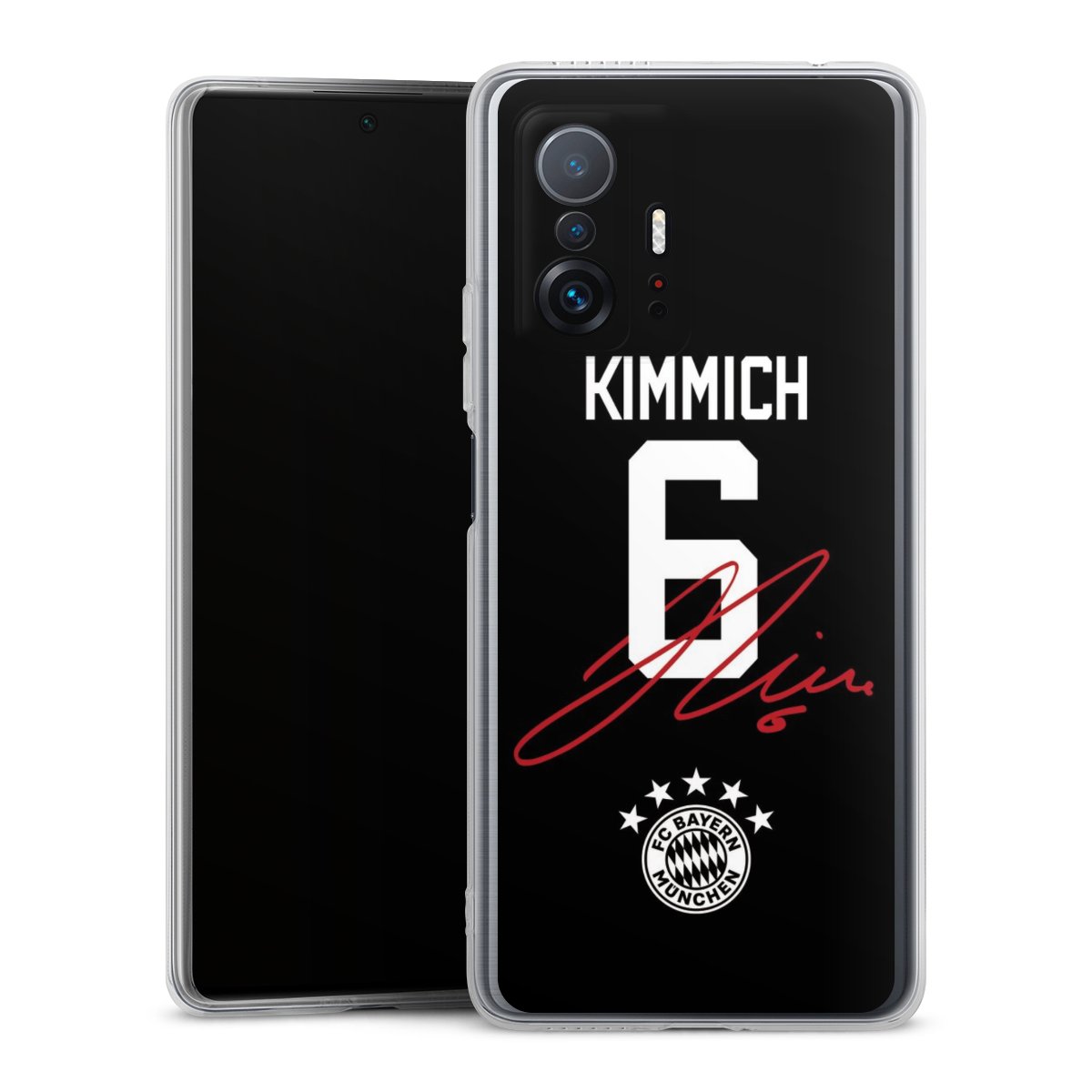 Coque en silicone