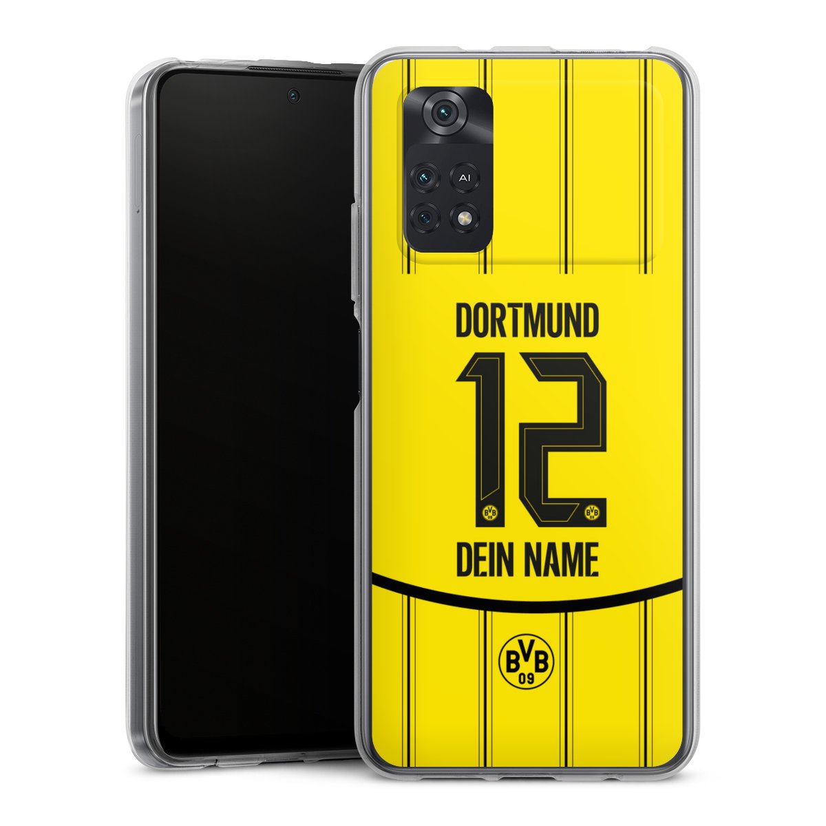 Borussia Dortmund Trikot Personalisierbar