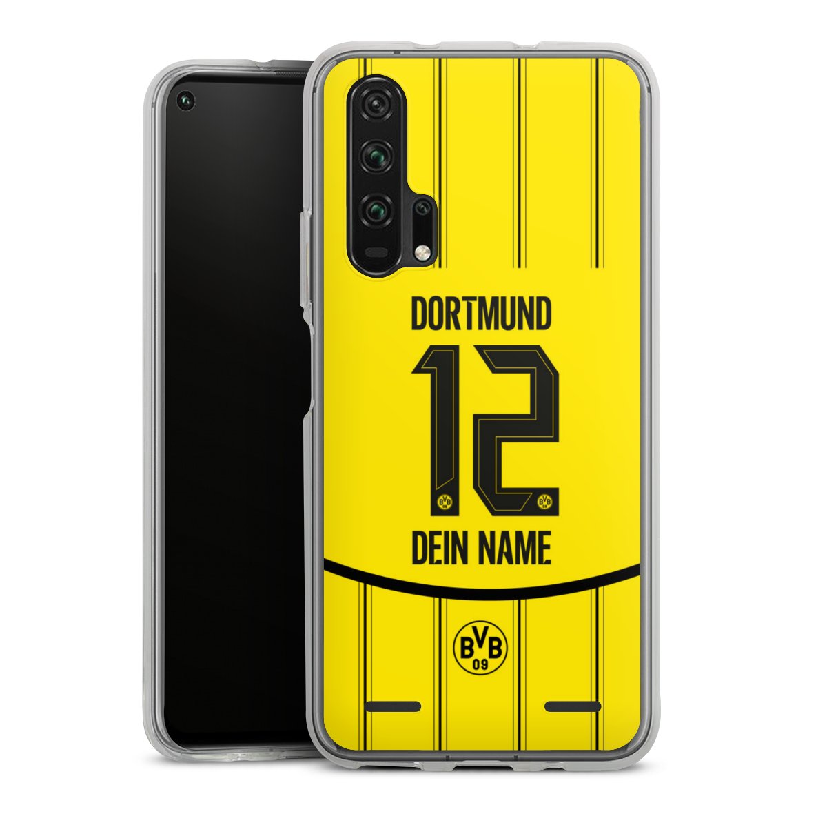 Borussia Dortmund Trikot Personalisierbar