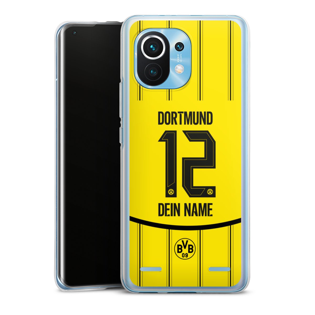 Borussia Dortmund Trikot Personalisierbar