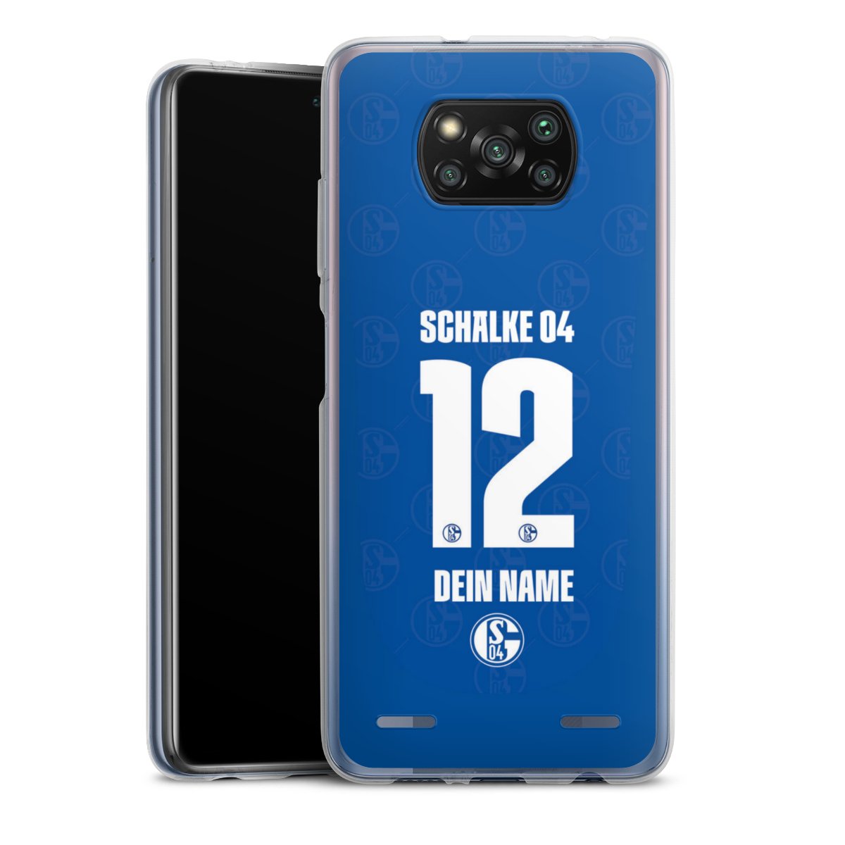 Schalke 04 Trikot Personalisierbar