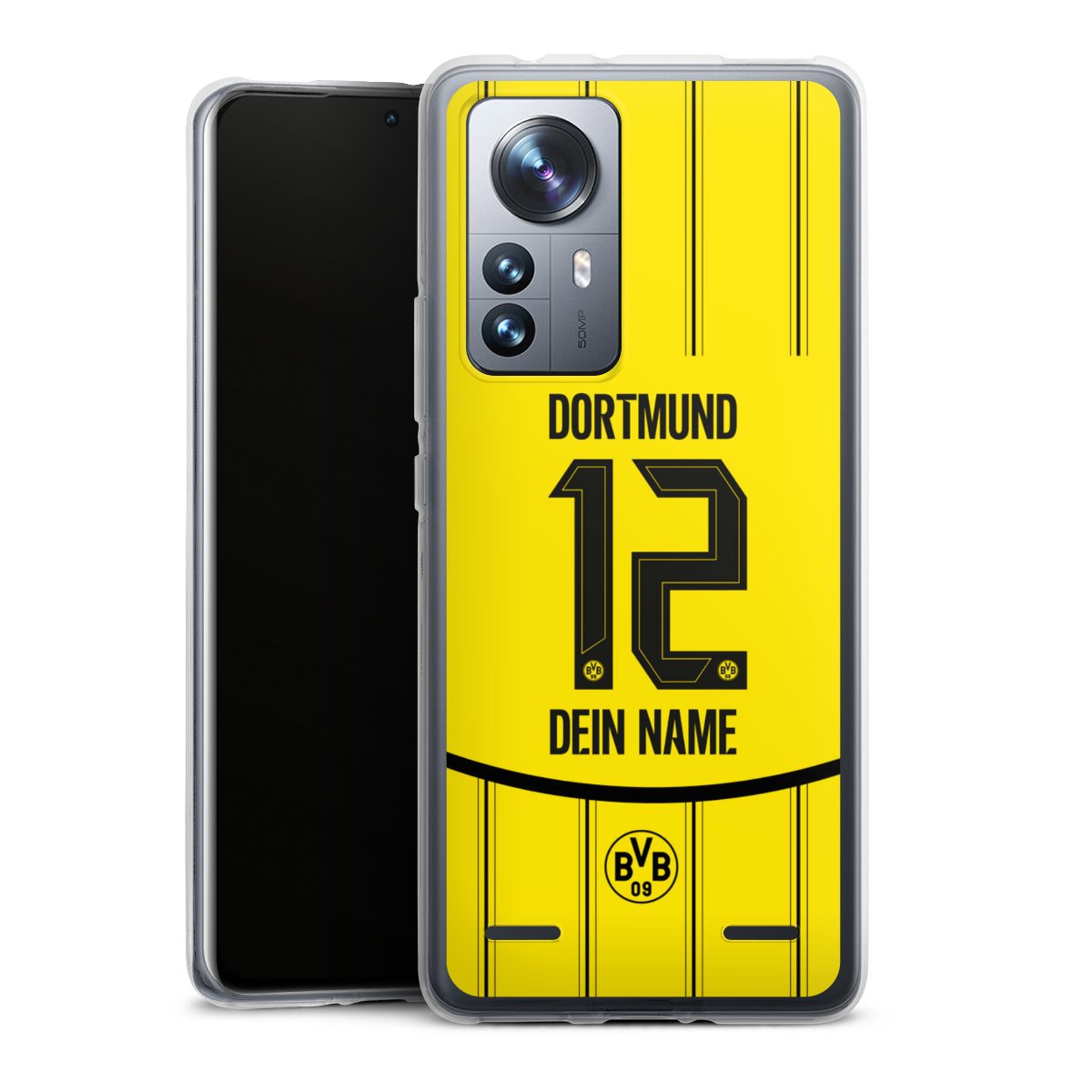 Borussia Dortmund Trikot Personalisierbar