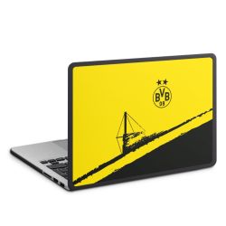 Hard Case for MacBook anthracite